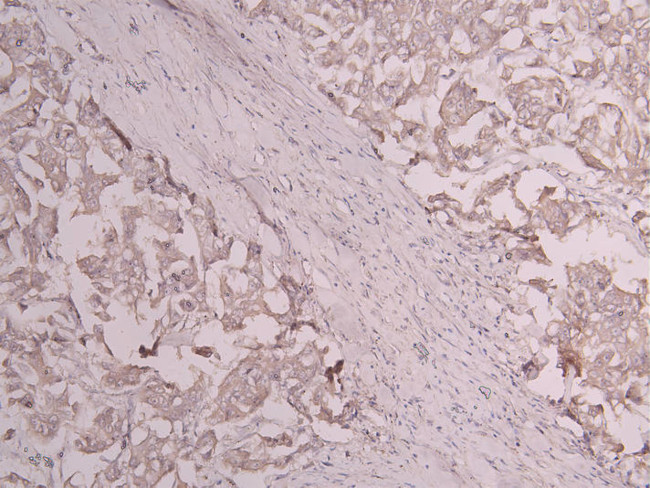 CD163 Antibody in Immunohistochemistry (Paraffin) (IHC (P))