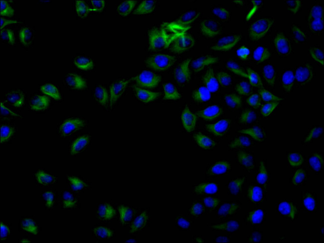 beta Tubulin Antibody in Immunocytochemistry (ICC/IF)