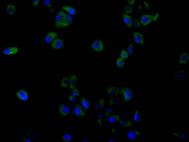 GLP1R Antibody in Immunocytochemistry (ICC/IF)