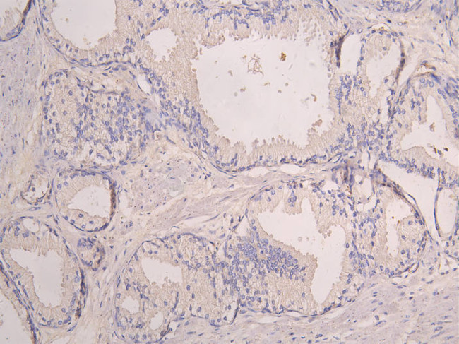 SIGLEC8 Antibody in Immunohistochemistry (Paraffin) (IHC (P))