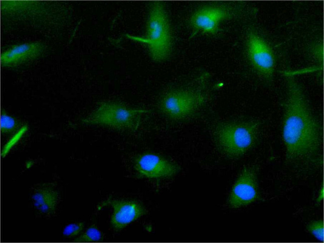 ILDR2 Antibody in Immunocytochemistry (ICC/IF)