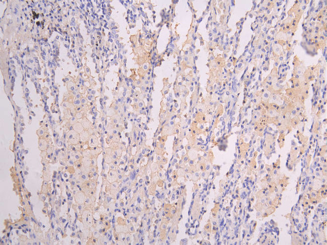 ICAM-1 Antibody in Immunohistochemistry (Paraffin) (IHC (P))