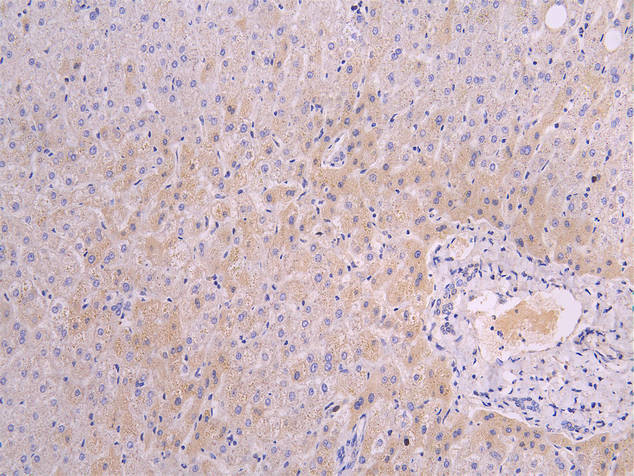 FGFR2 Antibody in Immunohistochemistry (Paraffin) (IHC (P))