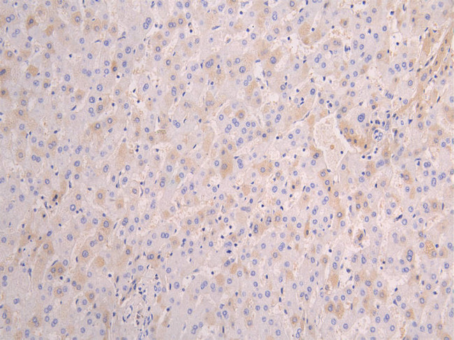 Serum Amyloid P Antibody in Immunohistochemistry (Paraffin) (IHC (P))