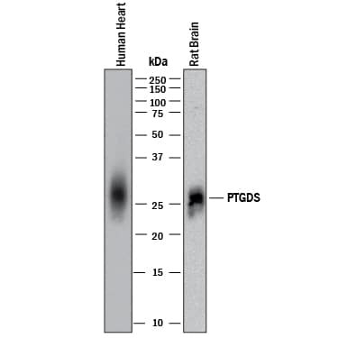 PTGDS Antibody in Western Blot (WB)