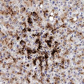 MT2A Antibody in Immunohistochemistry (Paraffin) (IHC (P))