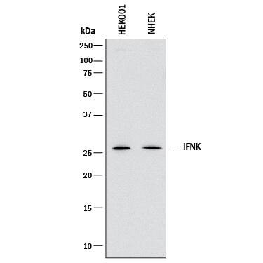 Interferon alpha-6 Antibody in Western Blot (WB)