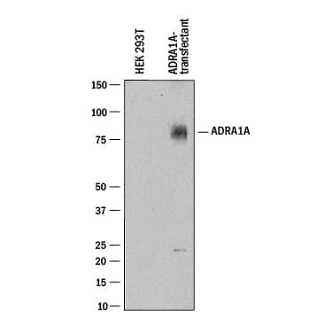 alpha-1a Adrenergic Receptor Antibody in Western Blot (WB)