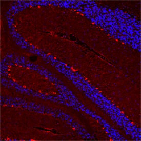 HTR2B Antibody in Immunohistochemistry (Paraffin) (IHC (P))