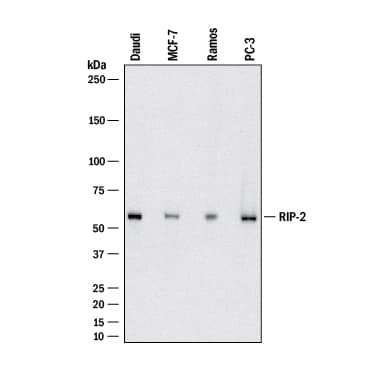 RIP2 Antibody in Western Blot (WB)