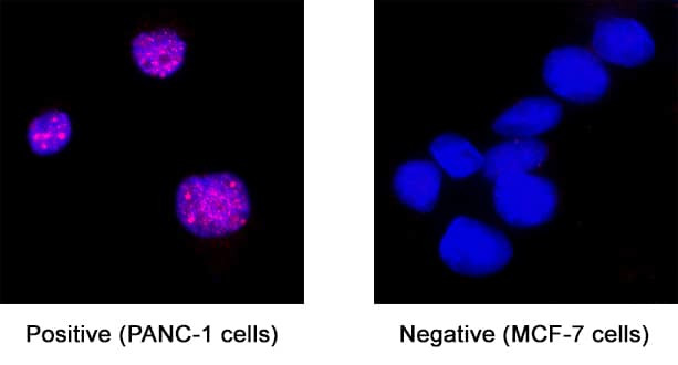 FOXL2 Antibody in Immunocytochemistry (ICC/IF)
