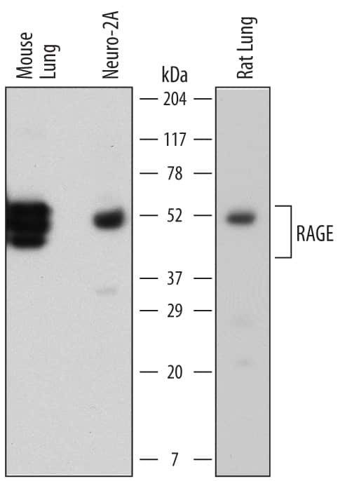 RAGE Antibody in Western Blot (WB)