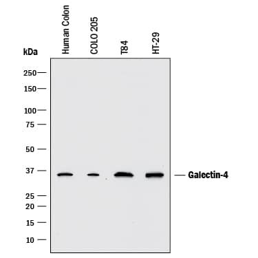 Galectin 4 Antibody in Western Blot (WB)