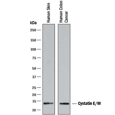 Cystatin M Antibody in Western Blot (WB)