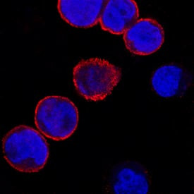 Galectin 8 Antibody in Immunocytochemistry (ICC/IF)
