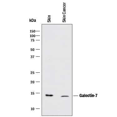 Galectin 7 Antibody in Western Blot (WB)