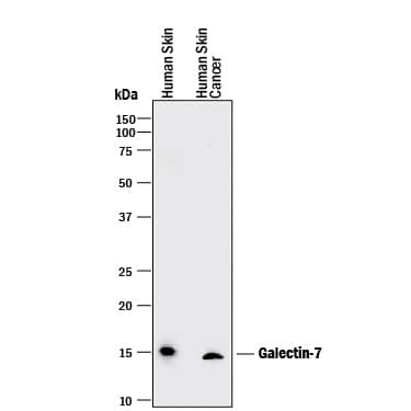 Galectin 7 Antibody in Western Blot (WB)