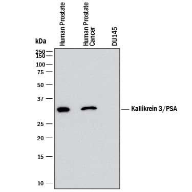 PSA Antibody in Western Blot (WB)