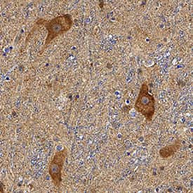 Parkin Antibody in Immunohistochemistry (Paraffin) (IHC (P))