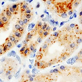 IL15RA Antibody in Immunohistochemistry (Paraffin) (IHC (P))