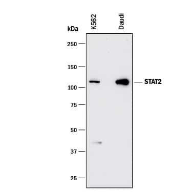 STAT2 Antibody in Western Blot (WB)
