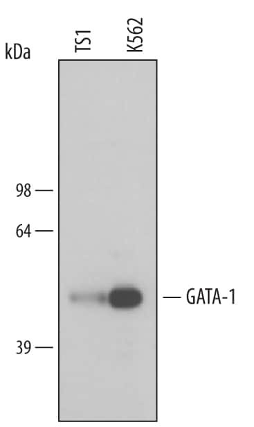 GATA1 Antibody in Western Blot (WB)