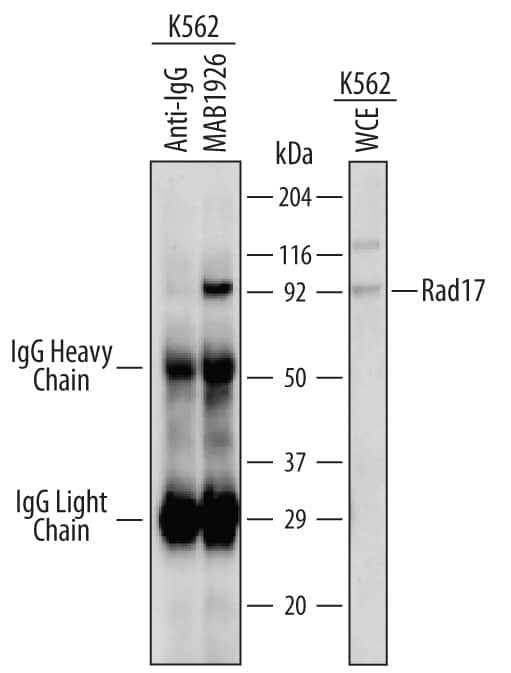 RAD17 Antibody in Immunoprecipitation (IP)