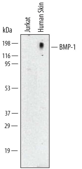 BMP1 Antibody in Western Blot (WB)