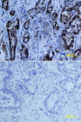 MIA Antibody in Immunohistochemistry (Paraffin) (IHC (P))