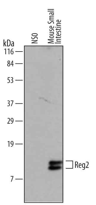 REG2 Antibody in Western Blot (WB)