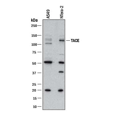 ADAM17 Antibody in Western Blot (WB)