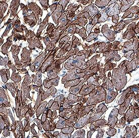 Laminin alpha-2 Antibody in Immunohistochemistry (Paraffin) (IHC (P))
