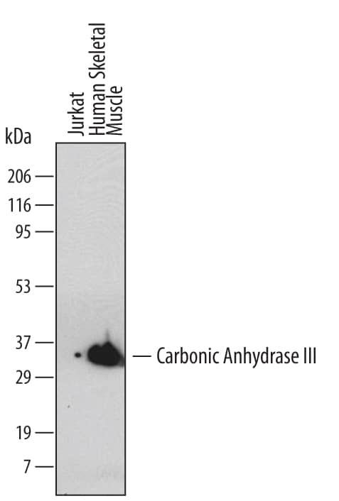 Carbonic Anhydrase III Antibody in Western Blot (WB)