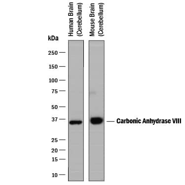 Carbonic Anhydrase VIII Antibody in Western Blot (WB)
