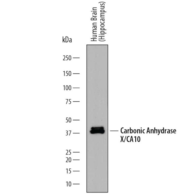 Carbonic Anhydrase X Antibody in Western Blot (WB)