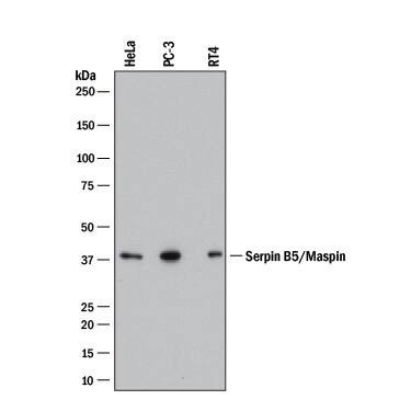 Maspin Antibody in Western Blot (WB)