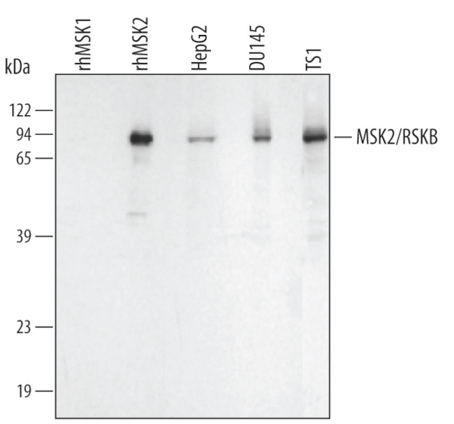 MSK2 Antibody in Western Blot (WB)