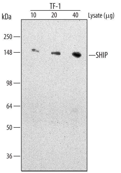 SHIP1 Antibody in Western Blot (WB)