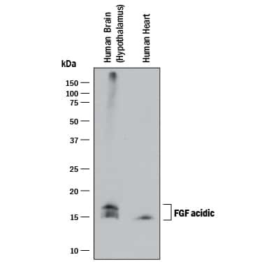 FGF1 Antibody in Western Blot (WB)