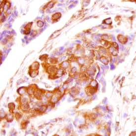FGF5 Antibody in Immunohistochemistry (Paraffin) (IHC (P))