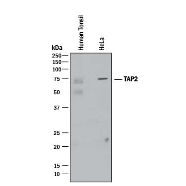 TAP2 Antibody in Western Blot (WB)