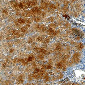 Plasma Kallikrein Antibody in Immunohistochemistry (Paraffin) (IHC (P))