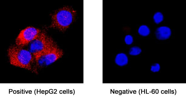 Midkine Antibody in Immunocytochemistry (ICC/IF)
