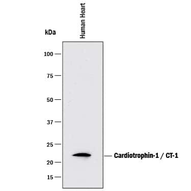 Cardiotrophin 1 Antibody in Western Blot (WB)