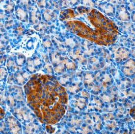 betacellulin Antibody in Immunohistochemistry (Paraffin) (IHC (P))
