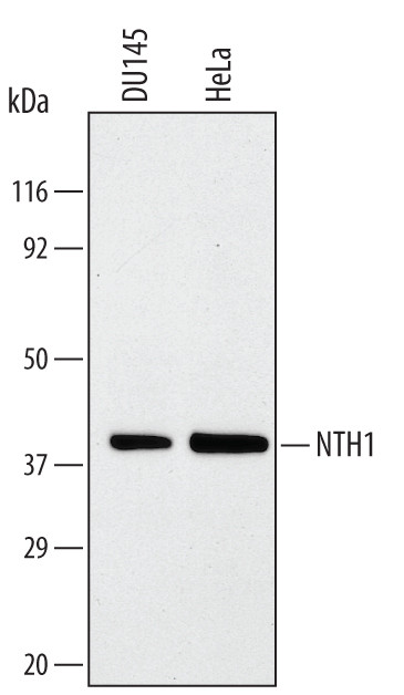 NTHL1 Antibody in Western Blot (WB)