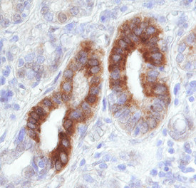 RelB Antibody in Immunohistochemistry (Paraffin) (IHC (P))