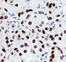 EGR1 Antibody in Immunohistochemistry (Paraffin) (IHC (P))