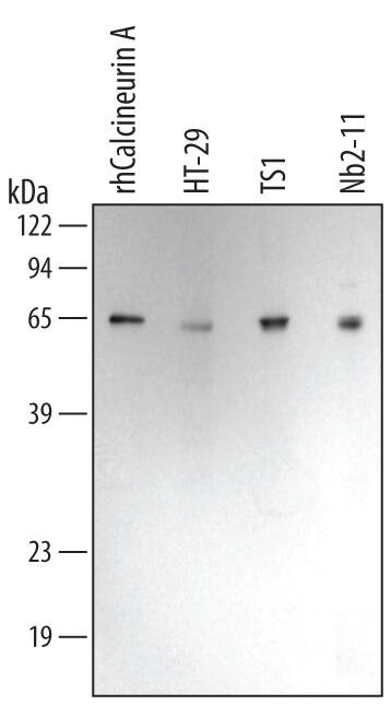 Calcineurin A Antibody in Western Blot (WB)