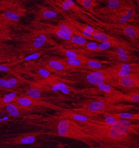OMD Antibody in Immunocytochemistry (ICC/IF)